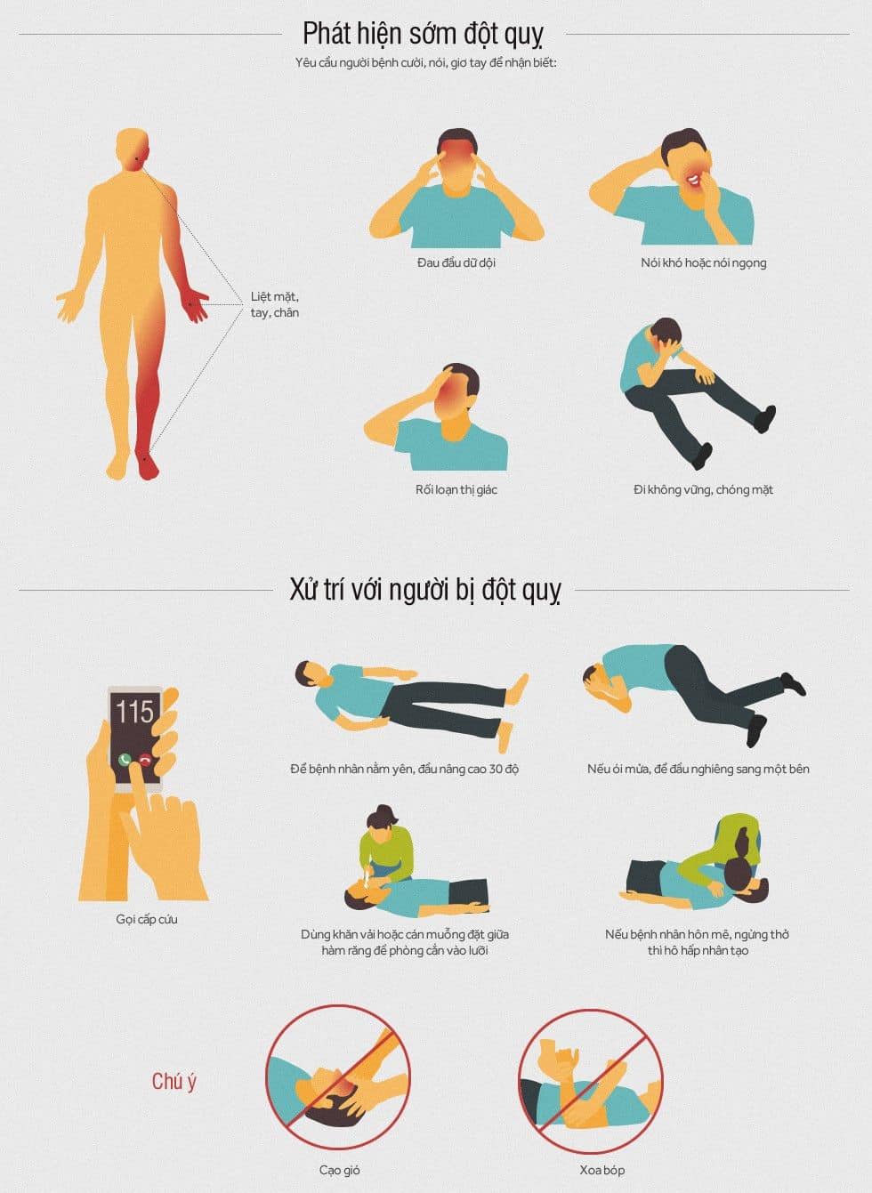 Xử lý đột quỵ tại nhà